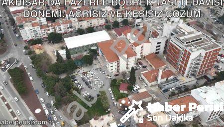 Akhisar’da Lazerle Böbrek Taşı Tedavisi Dönemi: Ağrısız ve Kesisiz Çözüm